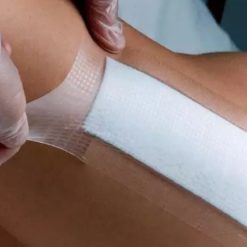 Alternative view of Curativo Opsite Post-Op